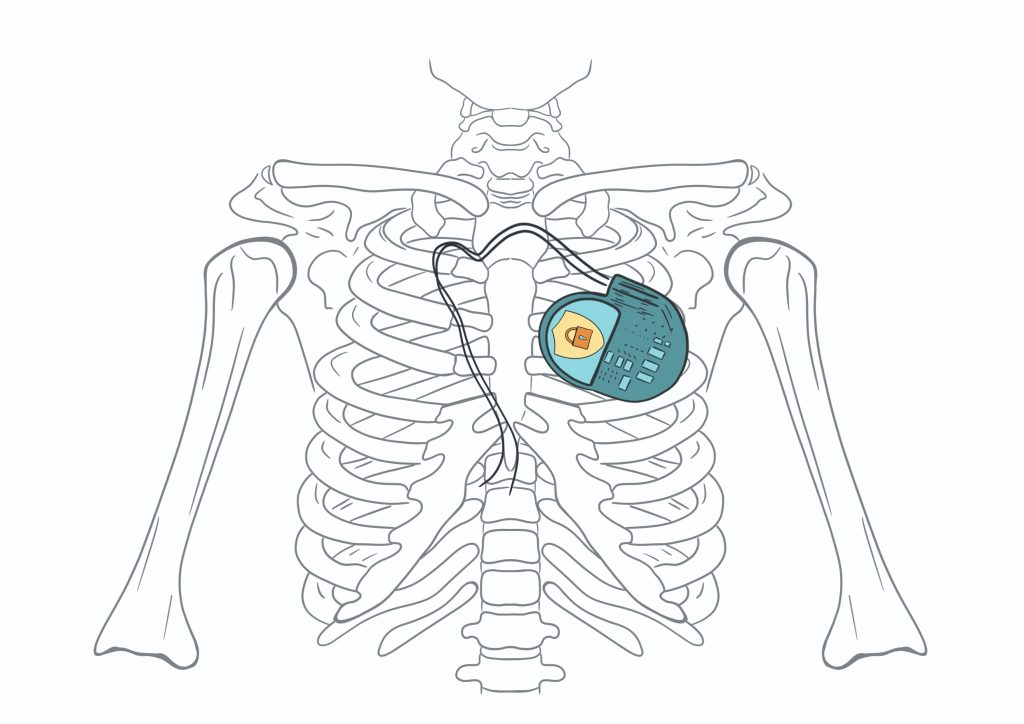 smart healthcare internet of medical things